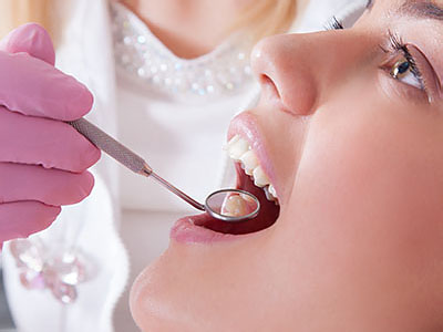 Woodside Dental | Dental Lab, Fluoride Treatment and Root Canals