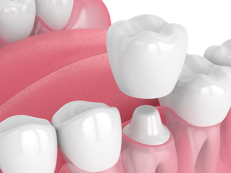 Woodside Dental
