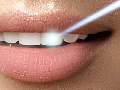 Woodside Dental | E4D, Periodontal Treatment and Cosmetic Dentistry